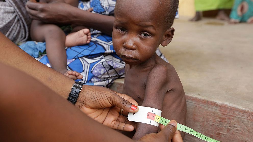 Undernärt barn i flyktinglägret i Yola, i den nigerianska delstaten Borno.