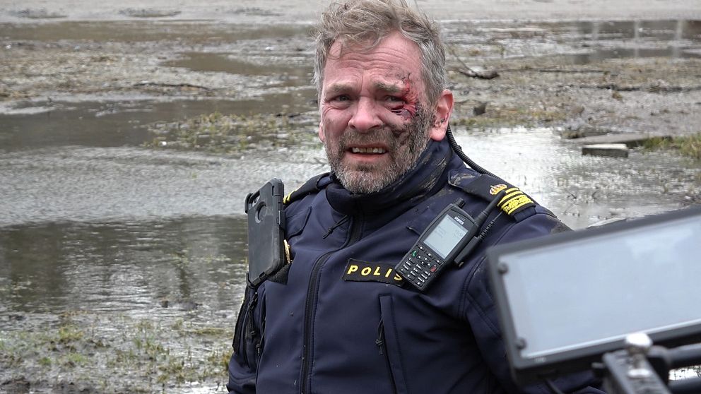 Filminspelning av tv-serien ”Tunna blå linjen 3”. Blodig skådespelare.