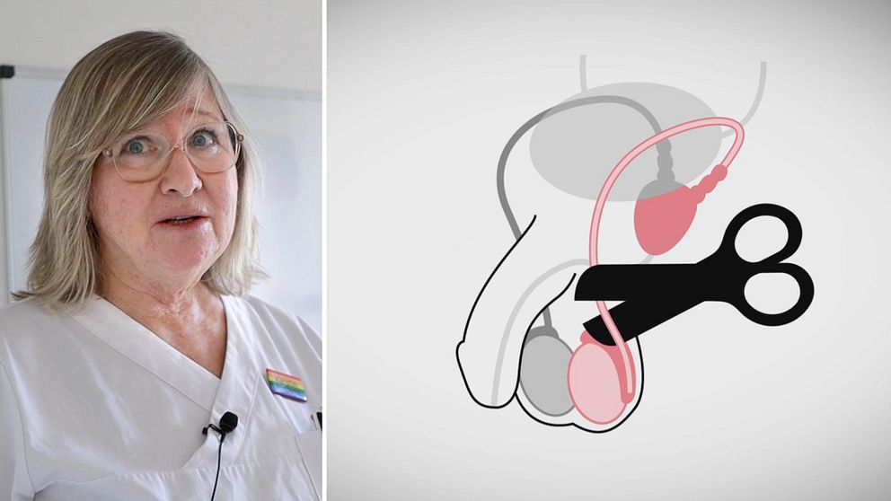 En person i vit arbetsklädnad som deltar i en presentation. Till höger visas en illustration av den manliga reproduktionssystemet med en sax som symboliserar ett ingrepp.