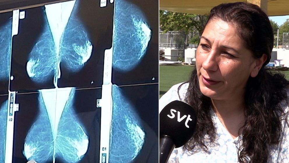 Bild på mammografiröntgen och en kvinna med utländsk bakgrund i Andersberg i Halmstad.