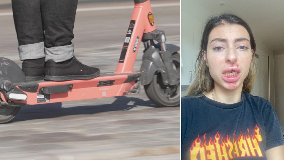 En elsparkcykel. Ellinor Zakhour med sprucken läpp.