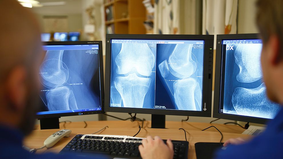 Tre datorskärmar visar röntgenbilder. Två personer som tittar på skärmarna syns snett bakifrån i förgrunden.
