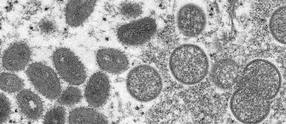 En mikroskopbild från 2003 visar mogna, ovala apkoppsvirioner erhållna från ett prov av mänsklig hud i samband med präriehundsutbrottet samma år.