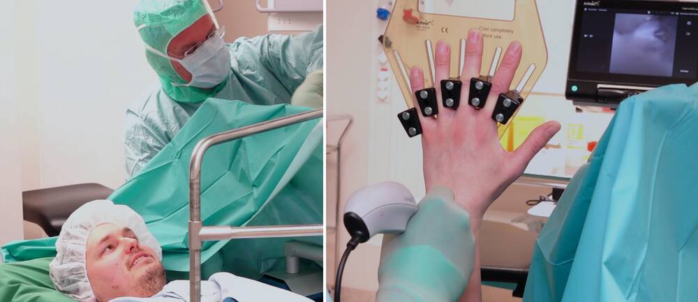 Bild på kirurger och en patient. Kirurgerna jobbar på Universitetssjukhuset Örebro där man nu är först i världen med ny nanoteknik där man inte behöver söva patienter i onödan.