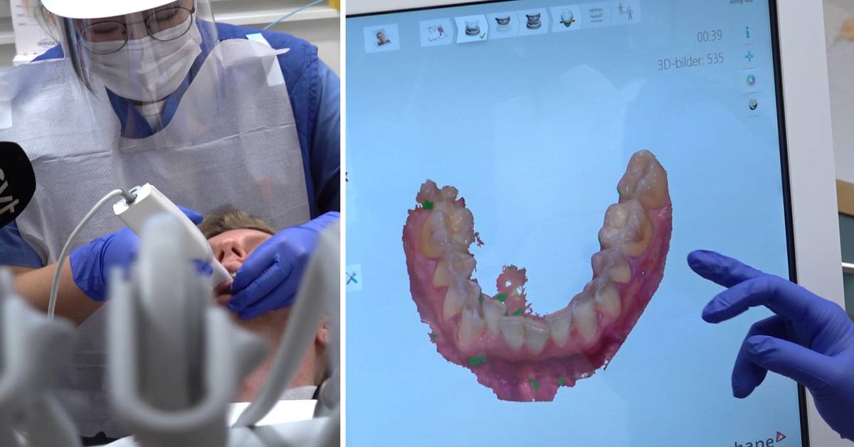 Reportern testar 3D-scanner hos tandläkaren: ”Det ser inte bra ut ...