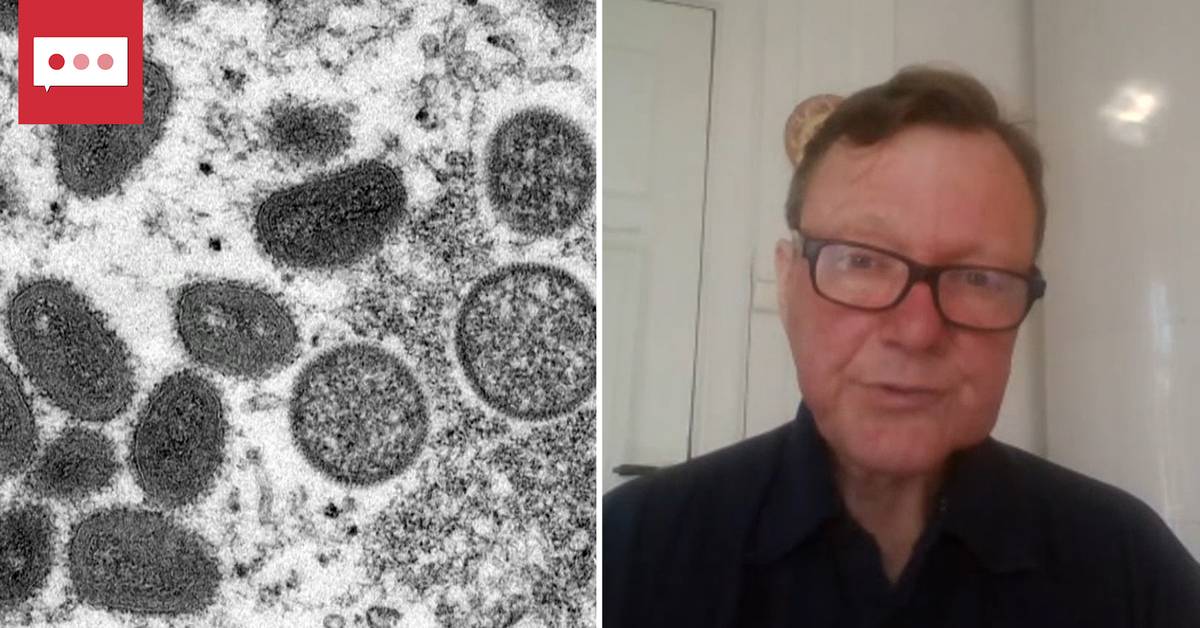 La prevalenza del vaiolo delle scimmie continua ad aumentare