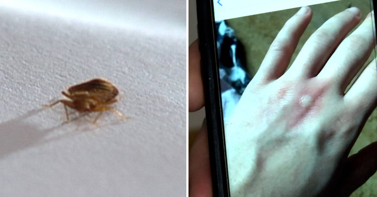 True and False About Bed Bugs "Do They Bite Three Times?" Teller Report