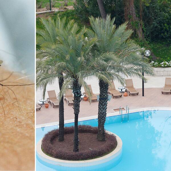 Mygga som sticker en människa. Bild på pool med palmer och solstolar.