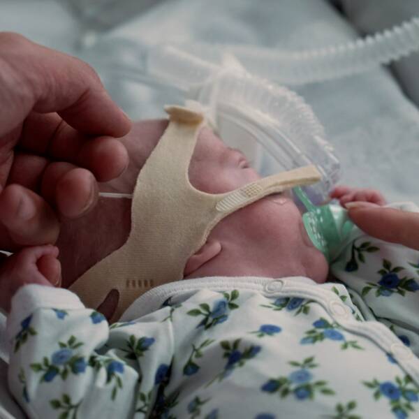 Alexander föddes i gravidvecka 27 och vårdas nu på neonatala intensivvårdsavdelningen på Västerviks sjukhus.