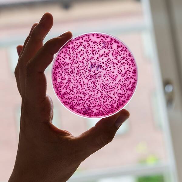 Odlingsplatta med bakterier, varav några är resistenta mot antibiotika, på laboratoriet vid antibiotikaforskningsenheten Klinisk mikrobiologi i Uppsala.