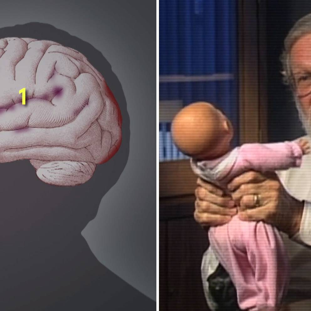 Shaken Baby Syndrome Fran Sanning Till Ifragasatt Diagnos Svt Nyheter