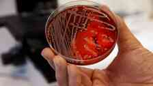Att bekämpa antibiotikaresistenta bakterier är något som måste ske internationellt och det måste skapas incitament för läkemedelsföretag att vilja utveckla nya läkemedel i kampen.