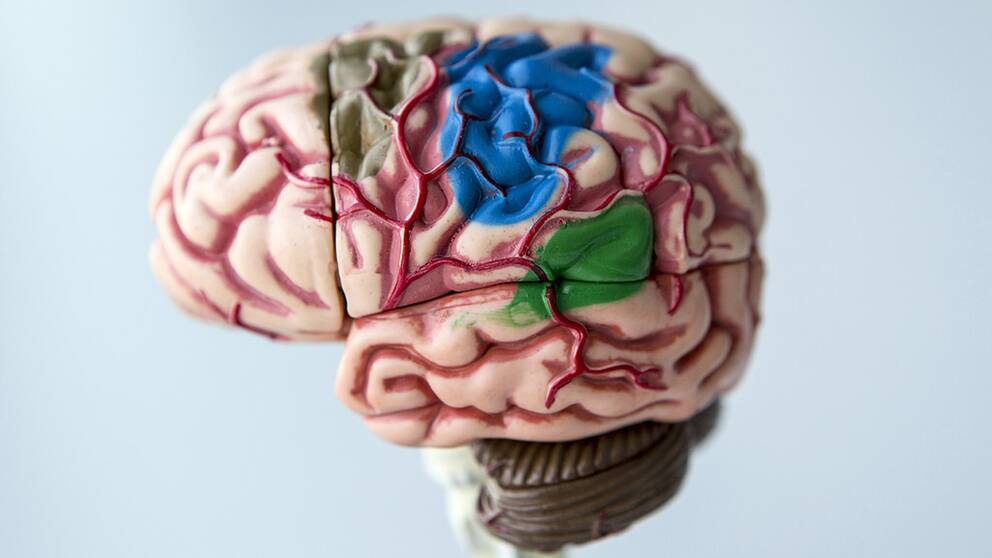 En hjärna i plast.