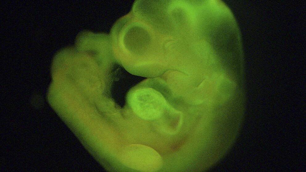 Stockholm 20 140 128 : Genom att injicera fluorescerande STAP-celler visar forskarna att dessa celler kan generera ett helt embryo. En enkel miljöförändring kan få vanliga celler i kroppen att förvandlas till stamceller, visar forskning. Genombrottet tros förenkla processen att ta fram ”skräddarsydda” stamceller till patienter väsentligt. Foto: HARUKO OBOKATA / Handout / kod 10500 **OBLIGATORISK BYLINE: HARUKO OBOKATA / ** **Endast för redaktionell användning. Bilden kommer från en extern källa och distribueras i sin ursprungliga form som en service till våra abonnenter**