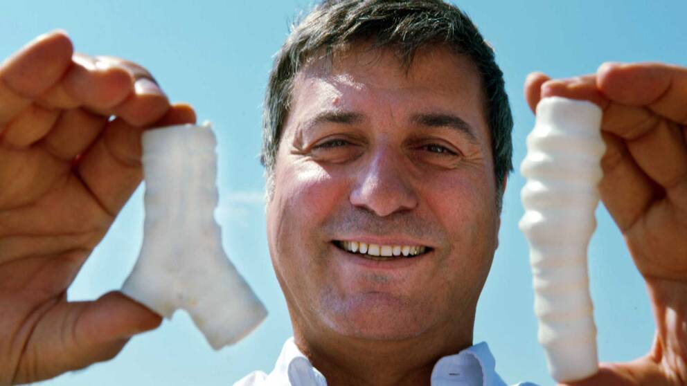 Paolo Macchiarini med plast strupar