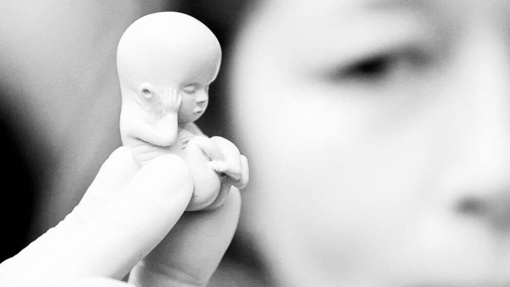 En kvinna håller upp en modell av ett litet foster vid en demonstration mot aborter i Irland 2012.