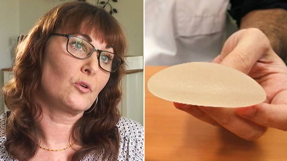 Gunilla Ranebo, en av 16 kvinnor som kräver ersättning för sina felaktiga implantat.
