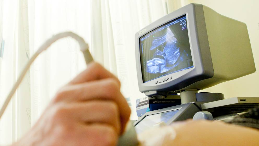 Hur sent får man göra abort