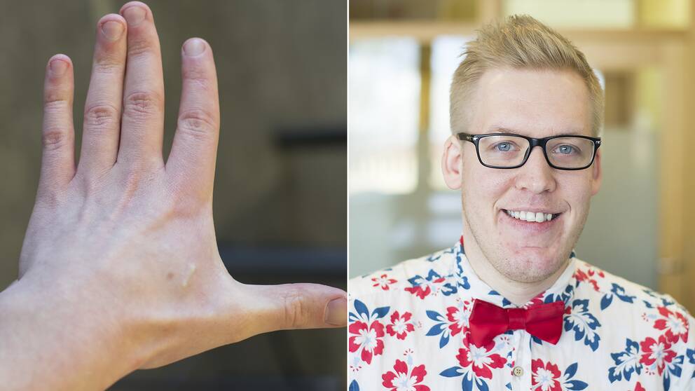 30-åriga Freddy Grip från Stockholm har implanterat två mikrochip, en i varje hand, sedan förra sommaren.