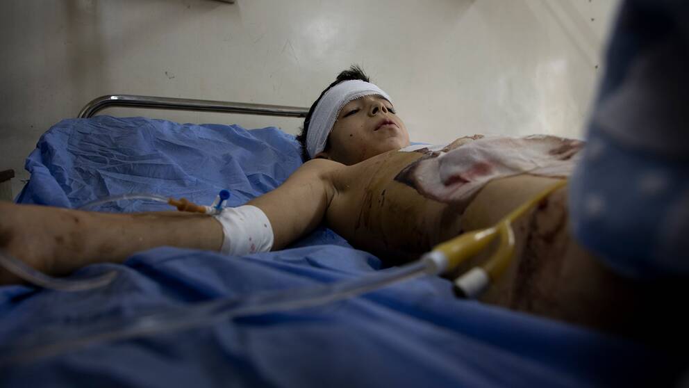 En splitterskadad pojke ligger på en sjukhussäng i Aleppo.