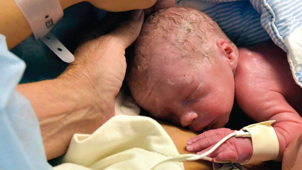 Mirakelbebisen – första att födas ur en transplanterad livmoder.