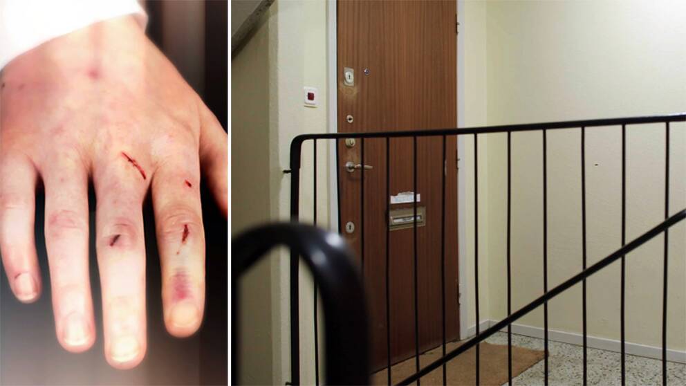 Hand med skador och blåmärken och en stängd dörr till lägenhet i trappuppgång.