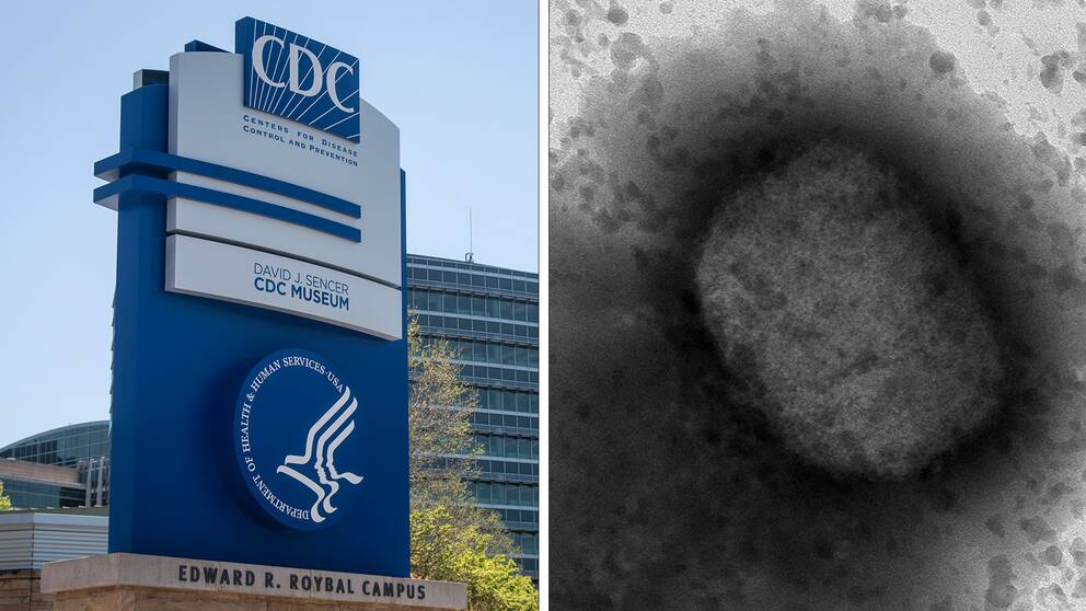 USA:s smittskyddsmyndighet CDC bredvid en bild på apkoppeviruset sett i ett mikroskop.