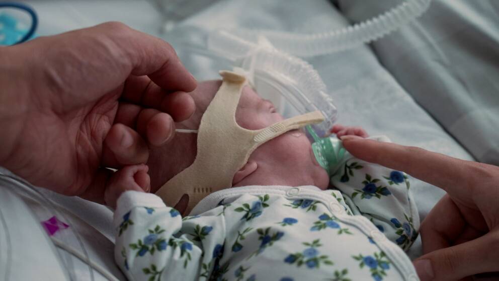 Alexander föddes i gravidvecka 27 och vårdas nu på neonatala intensivvårdsavdelningen på Västerviks sjukhus.
