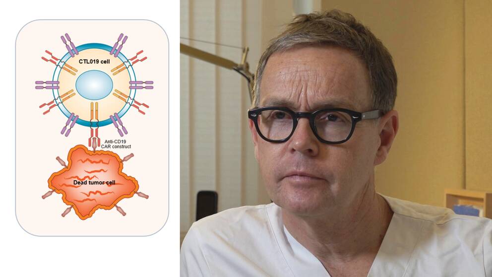 Mats Jerkeman, professor och överläkare på onkologiska kliniken i Lund