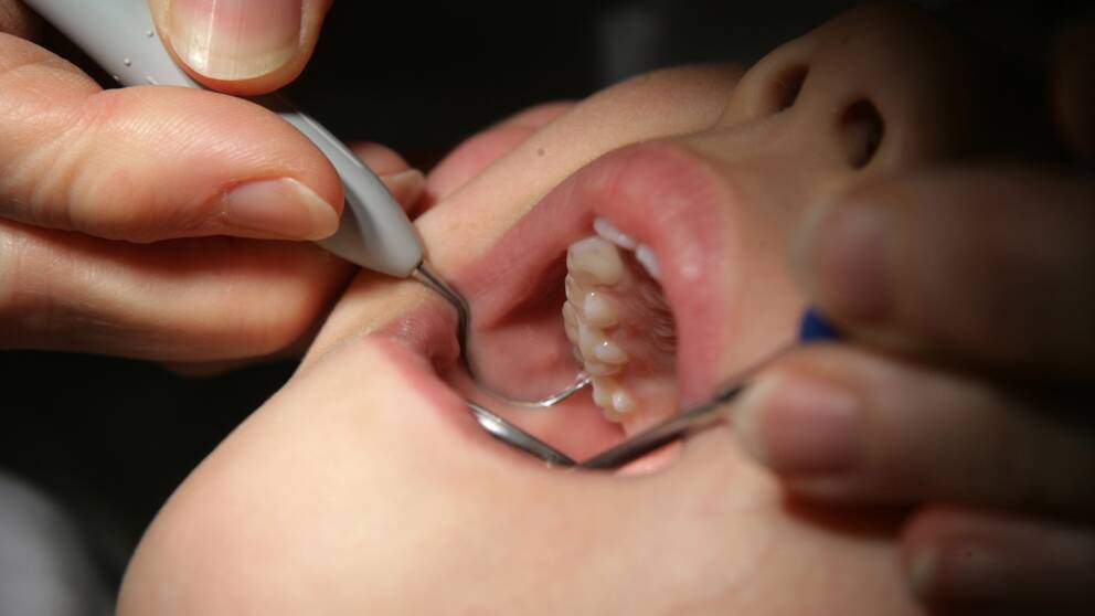 tandvård tänder tand tandhälsa barntänder tandläkare